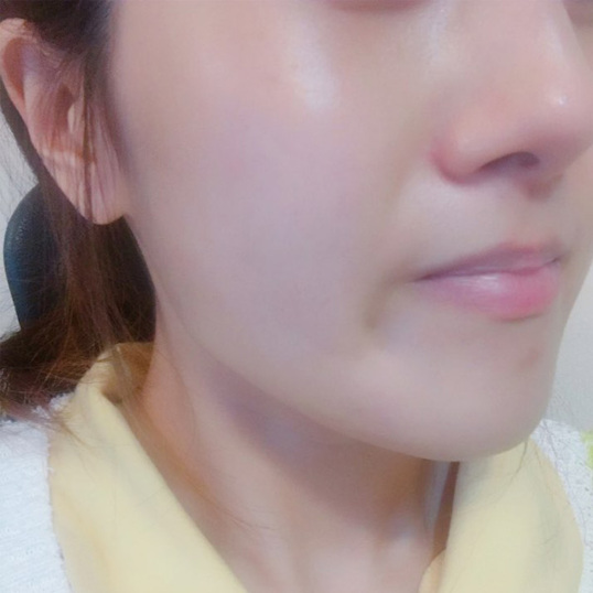 환절기 피부 당김 끝! 속부터 채워주는 달맞이꽃 수분재생크림 관리법